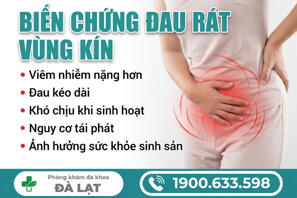 Hình ảnh minh họa